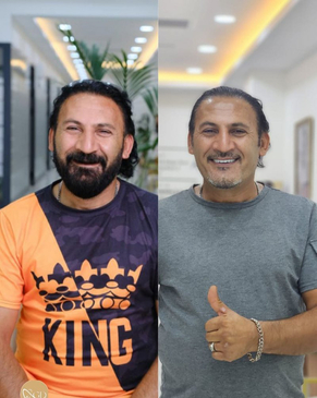 Slider image (7) Gordion Dental Clinic